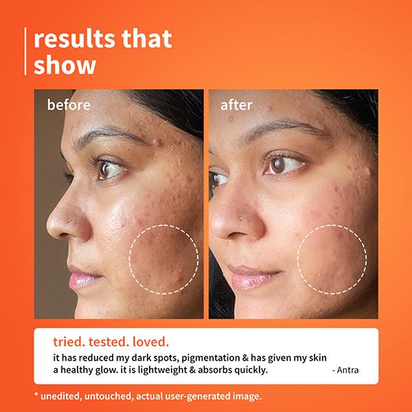 Plum Calendula & 10% Vitamin C Barrier Boosting + Glow Serum Boosts Glow Builds Skin Barrier 30 ml - Essences