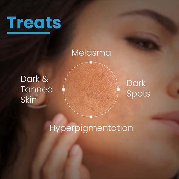 FCL AHA Lightening Gel, Glycolic Acid, Treats Hyperpigmentation, Dark spots, Reduce Dark Spots 15 ml - Scrubs & Exfoliants