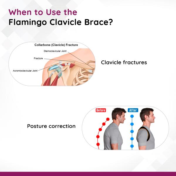 Flamingo Clavicle Brace (OC - 2018) (S) - Black - Back/Abdomen Supports