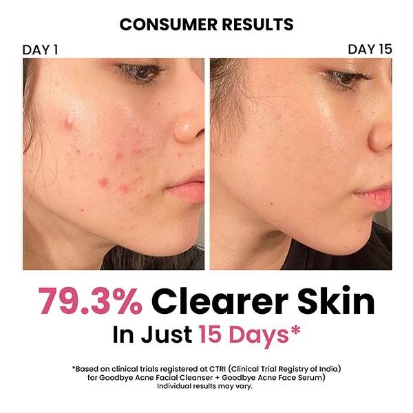 ThriveCo Acne-Free Sun Defense Kit (Anti-Acne Serum + Face Wash + SPF 50 PA++++ Sunscreen) 1's - Facial Kits