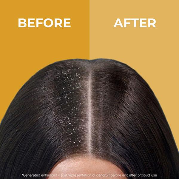 Organic Forest Anti Dandruff Shampoo 100 ml - Shampoos