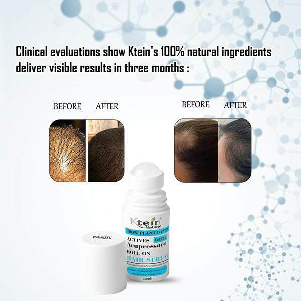 Ktein 100% Plant-Based Active Intensive Hair Treatment Serum with Acupressure Roll-On Therapy 30 ml - Hair Serums