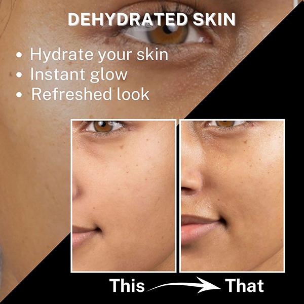 House of Beauty Tea Tree+Avocado Toner-Oily, Combination & Sensitive & Acne Prone Skin 100ml - Toners