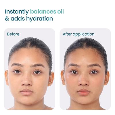 Wishcare 2.1.3 NMF Oil Free Water Gel Moisturizer for Oily & Acne Prone Skin with Niacinamide (50ml) - Face Moisturizers