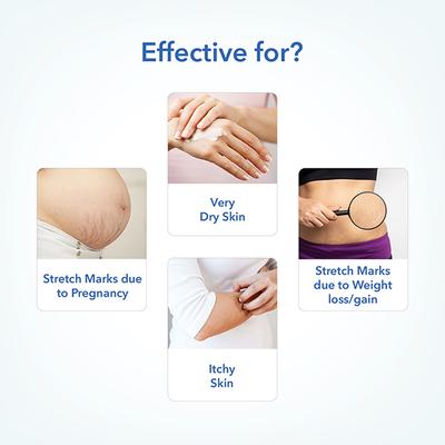 The Mom's Co. Natural Body Butter with Shea Butters, Sea Buckthorn & Roseship Oils 200gm - Body Butter