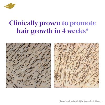 Dove Scalp + Hair Therapy Density Boost Revitalizing Scalp Serum 50 ml - Hair Serums