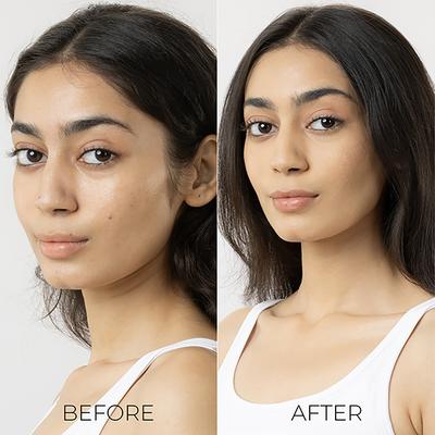 Brillare Salicylic Acid Body Lotion for Clear, Purified, Acne Prone Skin 200 ml - Lotions & Creams