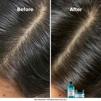 L'Oreal Professionnel Scalp Advanced Anti-Oiliness Dermo-Purifier Shampoo 300 ml - Shampoos