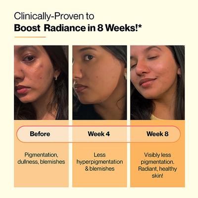 Setu Skin Renew - 30 Effervescent Tablets, Glutathione With Vitamin C, Gluta Fizz, Mixed Berry Flavour 1's - Multi-Vitamins