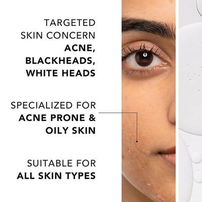 Novology 0.1% Thymol + Terpineol Acne Spot Corrector Gel 30 gm - Face Moisturizers