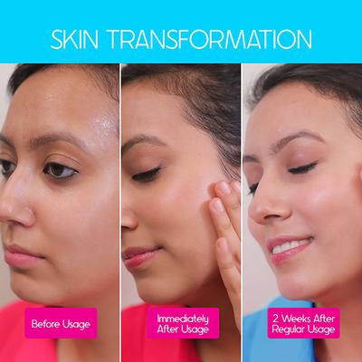 Cos IQ AirGel NMF 15 percent for Oily Skin Moisturizer for Men and Women 100 ml - Face Moisturizers