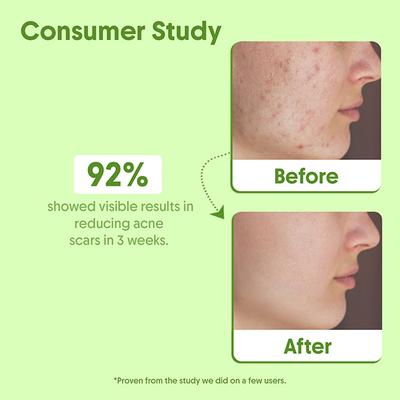 Aravi Organic Tea Tree Essential Oil 100% Pure Oil 15 ml - Essential Oils