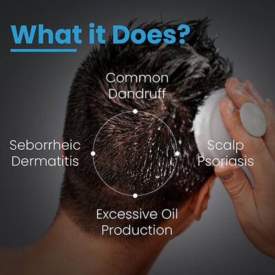 Fixderma Cosmetic Laboratories (FCL) Anti Dandruff T-Shampoo 200 ml - Shampoos