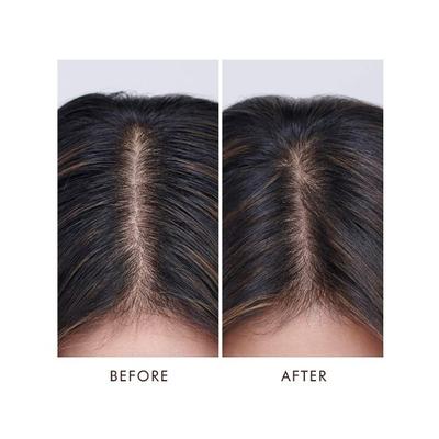 Moroccanoil Oily Scalp Treatment 45 ml - Hair Oils
