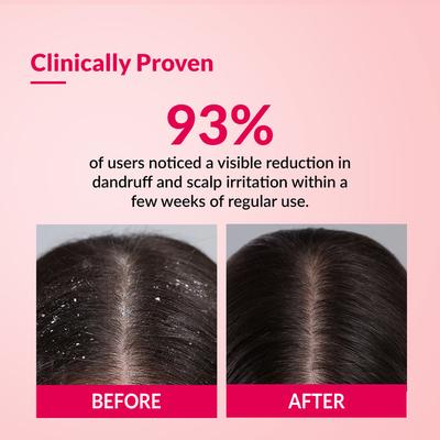 Fixderma Bioteez-S Anti Dandruff Shampoo - Flaky Scalp Condition, Relieves Itchy & Dry Scalp, Sulphate & Paraben Free 75ml - Dry Shampoos & Conditioners