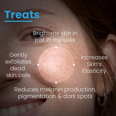 FCL PBA Brightening Face Mask Kojic Acid With Hyaluronic Acid for Glowing Skin 100 gm - Face Packs