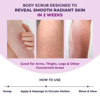 Sanfe Bumps Erasing Body Scrub for Rough Bumpy Skin Tan Strawberry Legs Remove Dirt, Dead Skin 100 gm - Creams, Lotions & Oils