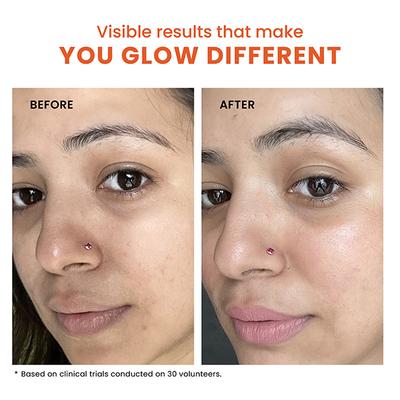 Foxtale The Stunner Skin Radiance Mask Cleans Pores & Reduces Blackheads Improve Skin Clarity & Tone 75gm - Masks & Peels