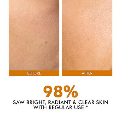 Conscious Chemist 10% Vitamin C Face Serum (Advanced) With Peptide For Glowing Skin 30ml - Face Serum