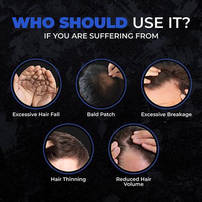 Beardo Scalp Regenesis Hair Growth Vitalizer 60ml - Hair Treatment