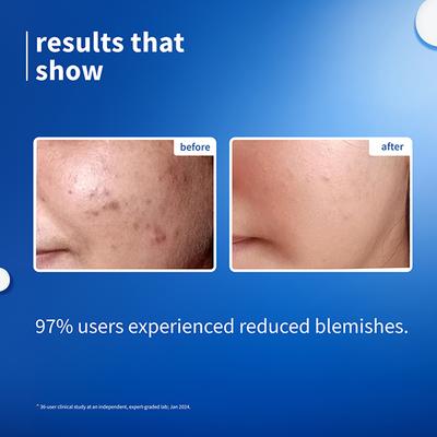 Plum 10% Niacinamide Face Serum with Rice Water Clarity Boost Fragrance free 15ml - Face Serum