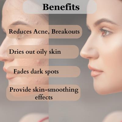 Dermistry Anti Acne 2% Salicylic Acid Foaming Face Wash 150 ml - Face Moisturizers