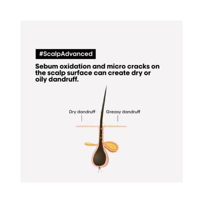 L'Oreal Professionnel Scalp Advanced Anti-Dandruff Dermo-Clarifier Shampoo 300 ml - Shampoos