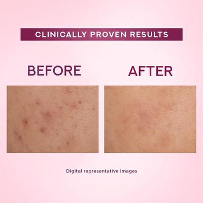 Pond's Bright Beauty Light Cream with UV Filter, Niasorcinol, Fades Dark Spots, Brightens Skin 35gm - Face Moisturizers