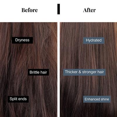 Bare Anatomy Hair Fall Control Shampoo + Hair Mask Kit DHT Blocker Women & Men 250ml + 250gm 1's - Shampoos