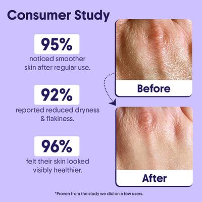 Aravi Organic 10% AHA + BHA Body Lotion 200 ml - Face Moisturizers