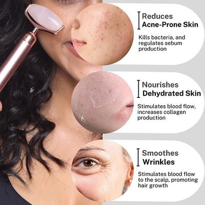 House of Beauty Rose Quartz Roller 1's - Derma Rollers