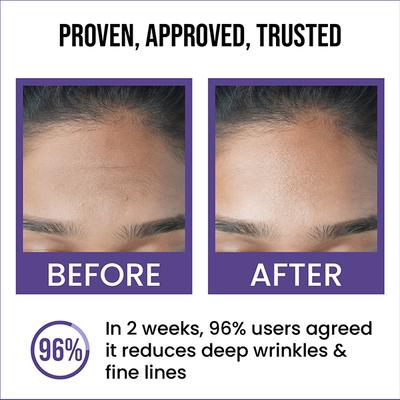 Insight Cosmetics 0.5% Retinol Anti-Ageing Face Serum 30 ml - Face Serum