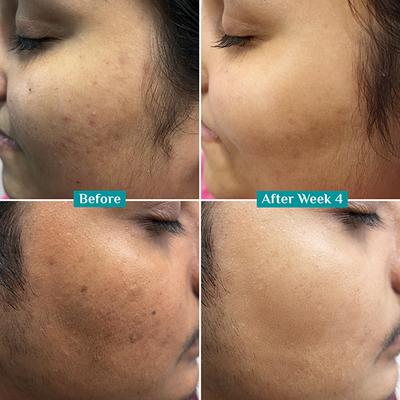 Pilgrim 10% Vitamin C Face Serum For Daily Brightness 10 ml - Face Mists