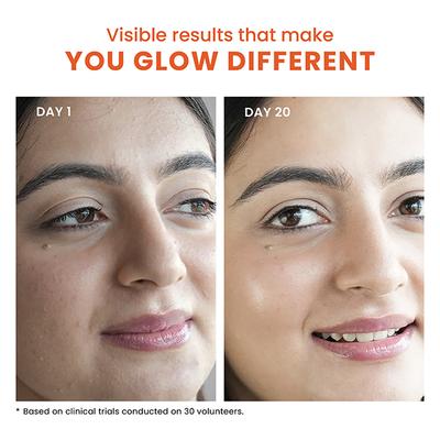 Foxtale The Dazzler Multivitamin Glow Toner + Makeup Setting Spray with Vitamin C + Provitamin B5 150 ml - Face Mists