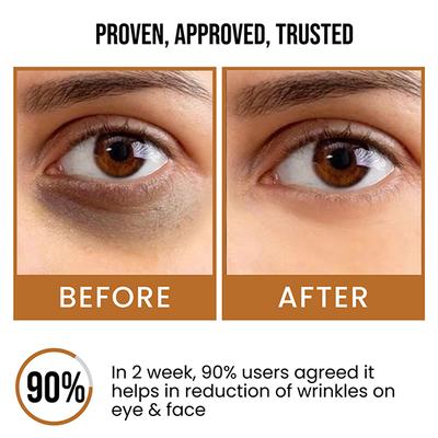 Insight Cosmetics Dark Circel & Spot Reduction Face Serum 30 ml - Face Serum