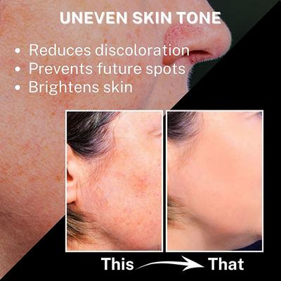 House of Beauty Super Fruit Glow Oil with Peach+Jojoba-All Skin Type For Massage & Primer 10ml - Face Oils