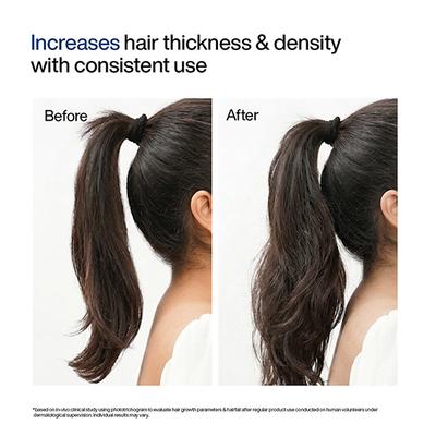 Wishcare Hair Growth Serum Concentrate with Redensyl - In-Vivo Tested-Boosts Hair Growth (100ml) - Hair Combs