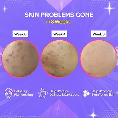 Chicnutrix Glow - Glutathione & Vitamin C For Skin Radiance - Strawberry & Lemon Flavour 20 Tablets 1's - Hair & Skin