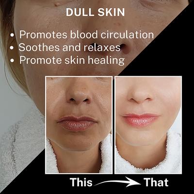 House of Beauty Jade Roller For Oily Skin Helps Tone, Tighten, Depuff Face & Under Eyes 1's - Derma Rollers