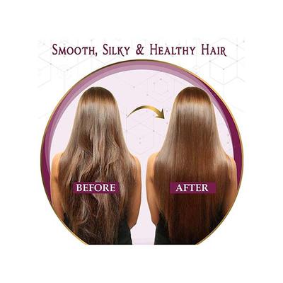 Aravi Organic 100% Pure Onion Hair Growth Carrier Hair Oil 200 ml - Hair Oils