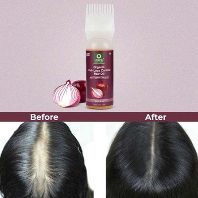 Organic Harvest Onion Hair Oil for Hair 150 ml - Hair Oils