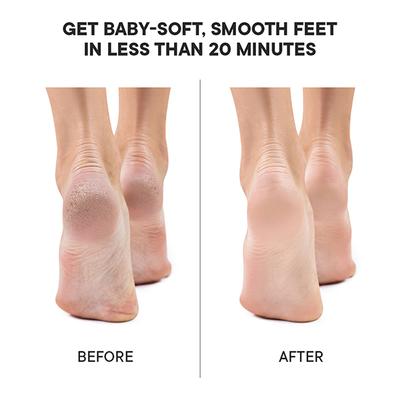 Quench Botanics Pedicure Foot Mask (with Matcha Green Tea) 1's - Masks & Peels