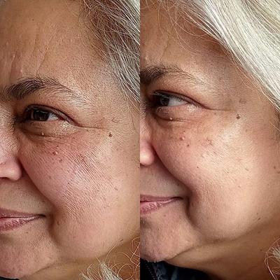 HOB Face Lift Pro Micro Currenting Face Massager Tool for Skin Lifting Instantly at Home 1's - Massagers