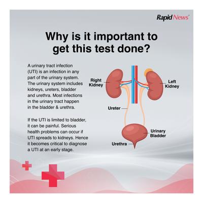 Rapid News Urinary Tract Infection Instant Urine Test Kit 3's - Test Strips & Lancets