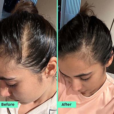 PLIX 3% Redensyl Hair Growth Serum with 4% AnaGain, 3% Baicapil, Stimulates Hair Growth, Increase Hair Density & Thickens Hair for Men & Women 50 ml - Hair Serums