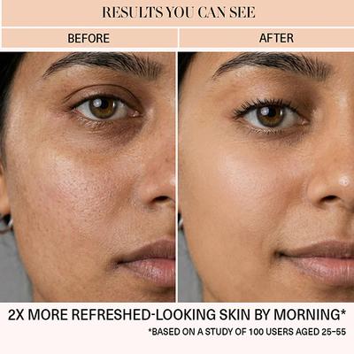 Bie- Beauty By Bie DND Overnight Mask 50 gm - Masks & Peels