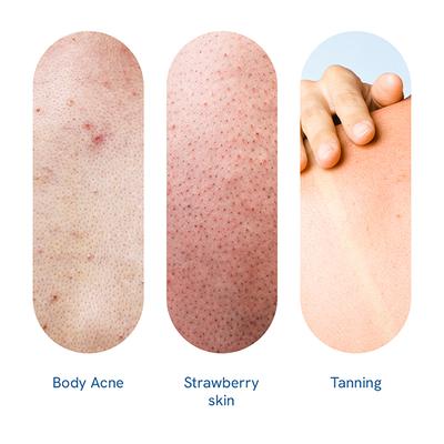 Be Bodywise 10% Aha Body Scrub For Even Skin Texture 200 gm - Scrubs & Exfoliants