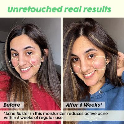 Plix The Plant Fix - The Plant Fix 2% Niacinamide Jamun Moisturizer 30 gm - Face Moisturizers