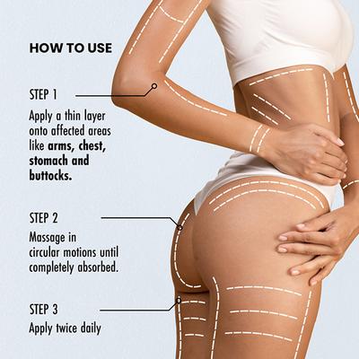 Thriveco Stretch Mark Expert Serum Cream 30 ml - Creams/Oils/Lotions