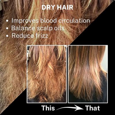 House of Beauty Blackseed Onion Oil Reduces Hair Fall With Real Kalonji Seeds Benefits 200ml - Hair Oils